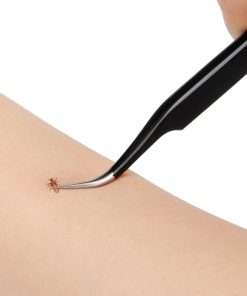 COITEK 3 in 1 Tick Remover Kit, Black Tick Remover Tweezers Stainless Steel Tick Remover Tools Set for Pet Dog, Cat, Human with Storage Box (Black) - 6