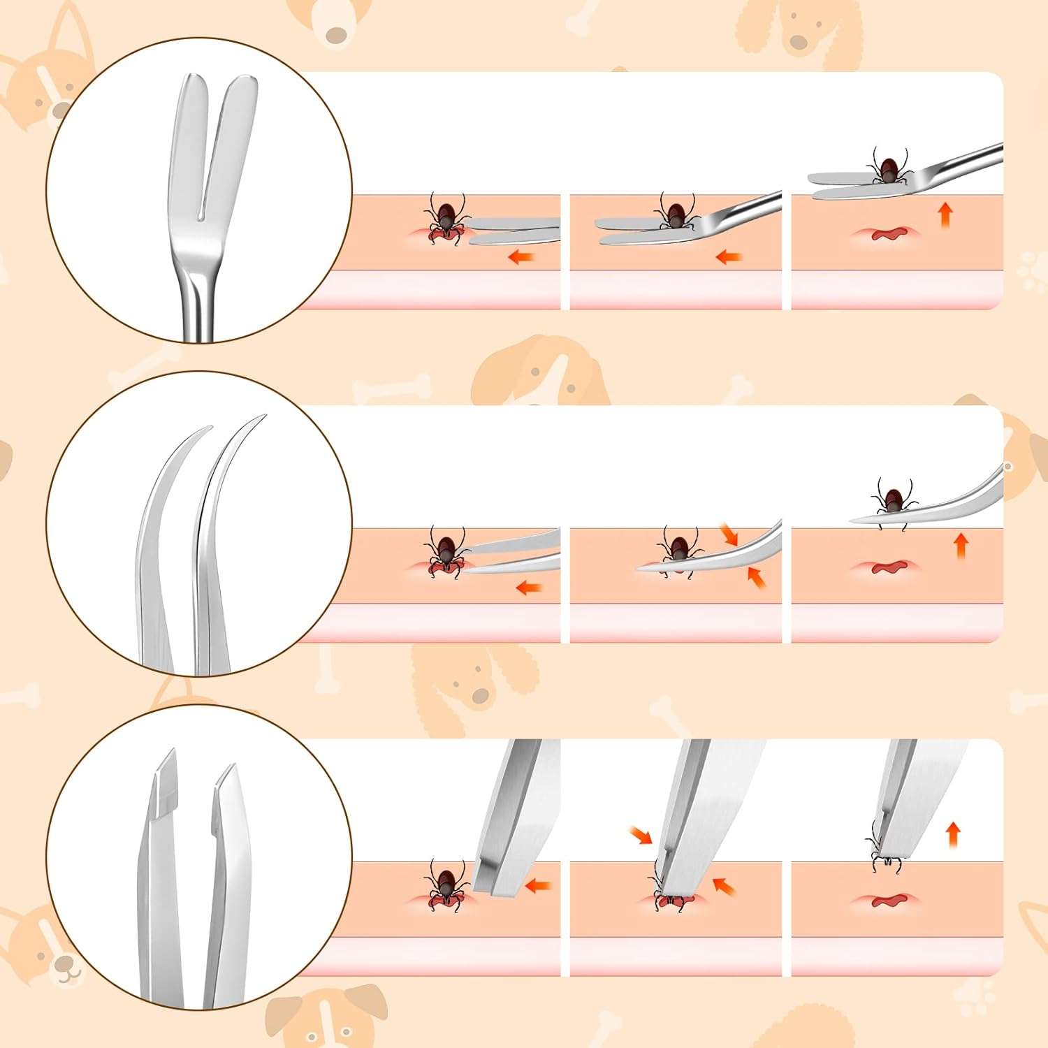 Rypet Tick Remover Tool Set - Stainless Steel Tick Remover Kit for Cats Dogs and Humans(Pack of 3) - 4