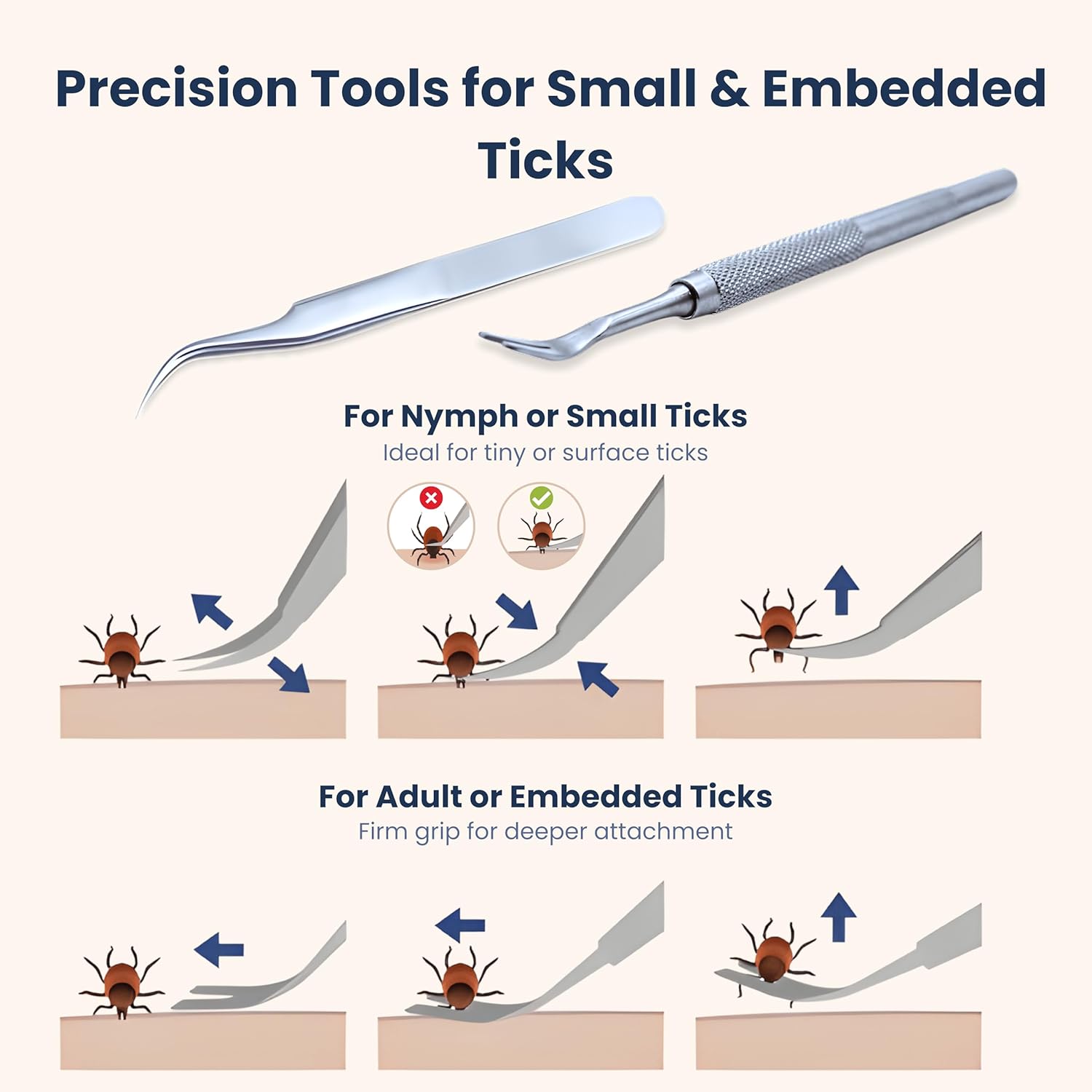 Complete Tick Removal Kit for Dogs & Cats – Tick Remover Tool Set with 3 Size Hooks, Tick Comb & Stainless Steel Precision Tick Remover + Tweezers, Travel Pouch – Safe, Fast Tick Removal (1) - Image 6